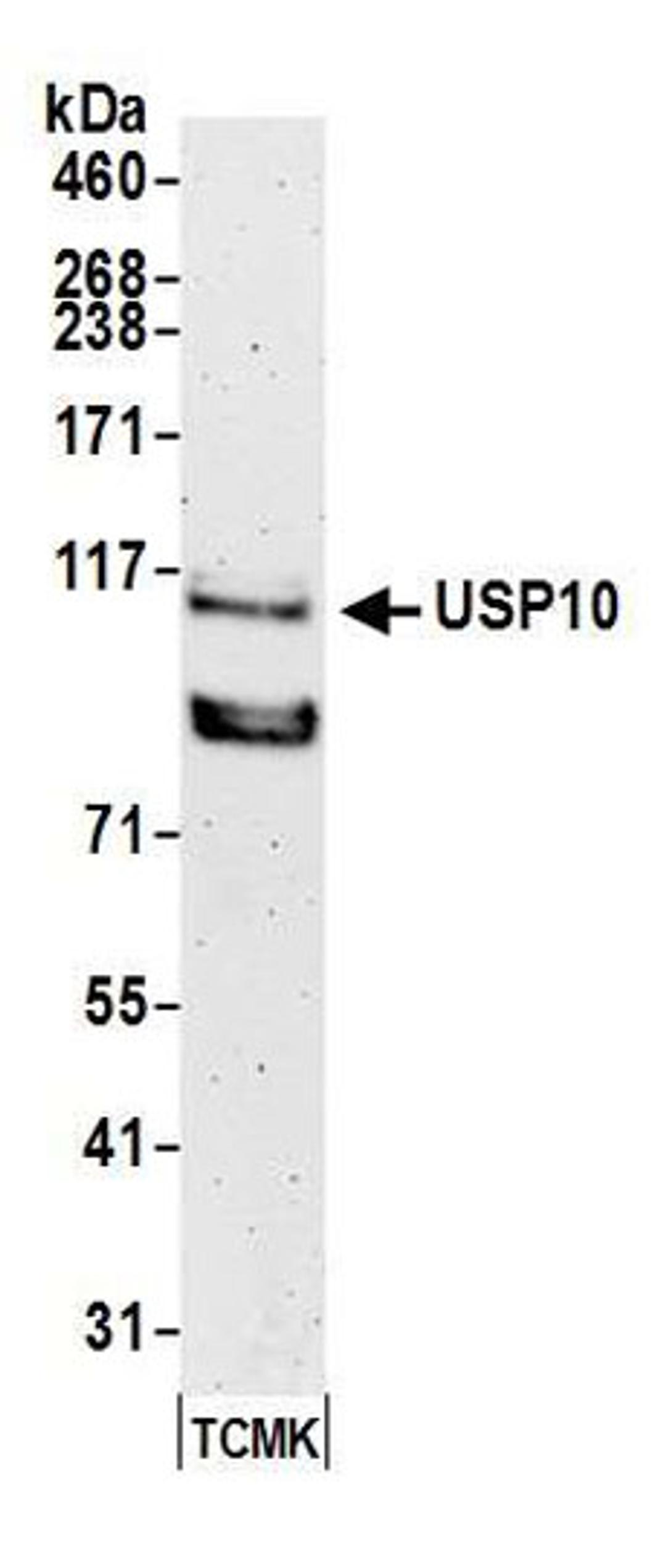 Detection of mouse USP10 by western blot.