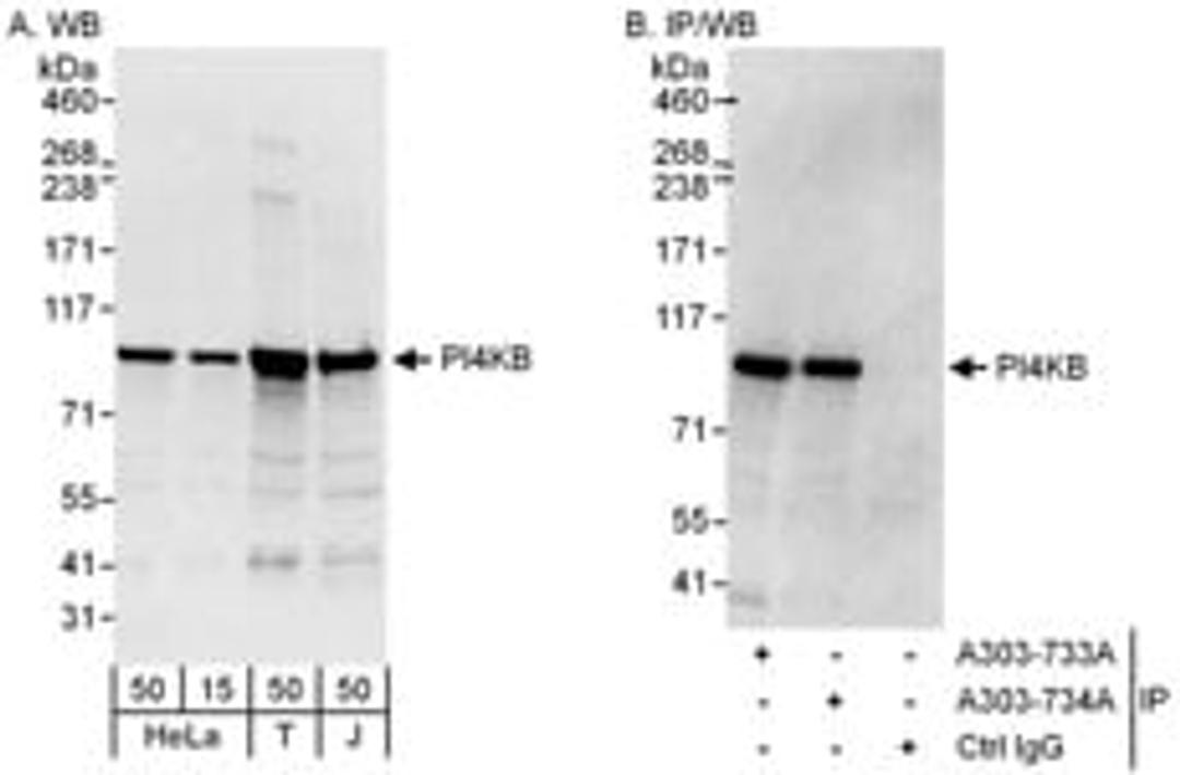 Detection of human PI4KB by western blot and immunoprecipitation.