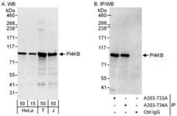 Detection of human PI4KB by western blot and immunoprecipitation.