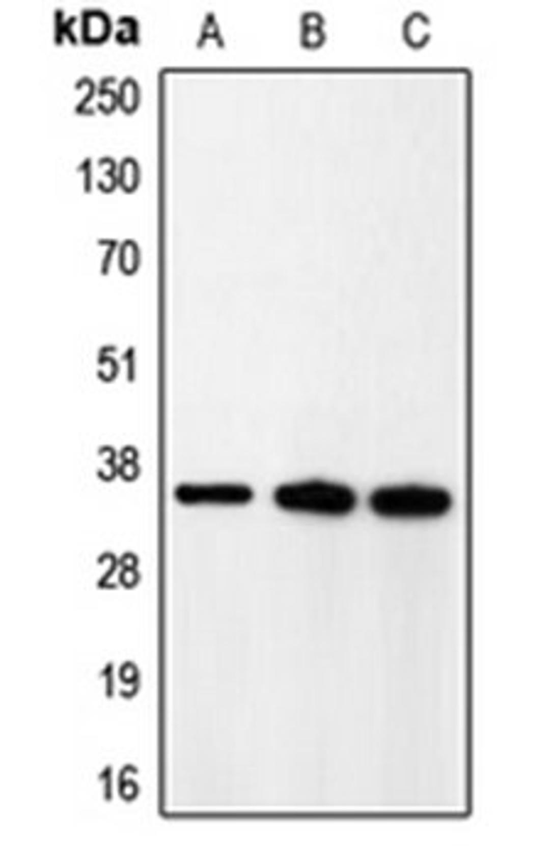 Western blot analysis of rat brain (Lane 1), HeLa (Lane 2), A431 (Lane 3) whole cell lysates using CDK5R1 antibody