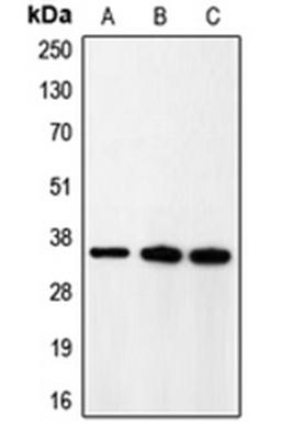 Western blot analysis of rat brain (Lane 1), HeLa (Lane 2), A431 (Lane 3) whole cell lysates using CDK5R1 antibody