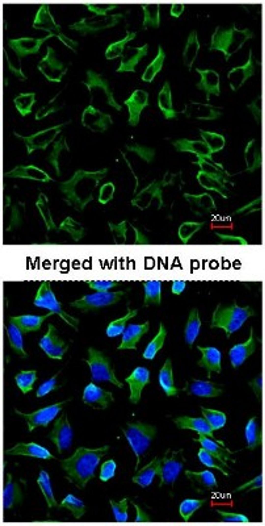 Immunocytochemistry/Immunofluorescence: Natriuretic Peptide Receptor C Antibody [NBP1-31365] - Immunofluorescence analysis of HeLa, using NBP1-31365 at 1:200 dilution.