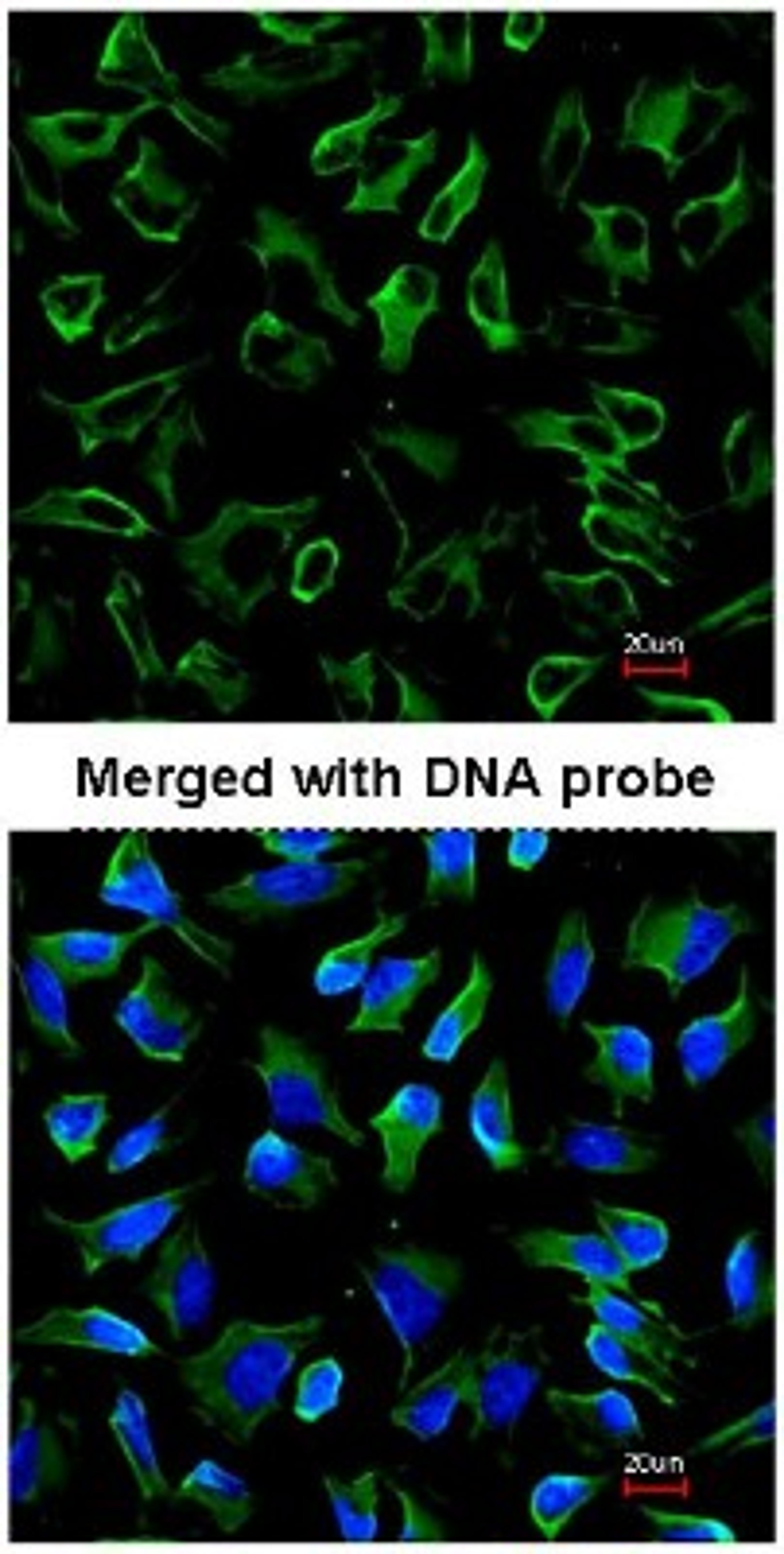 Immunocytochemistry/Immunofluorescence: Natriuretic Peptide Receptor C Antibody [NBP1-31365] - Immunofluorescence analysis of HeLa, using NBP1-31365 at 1:200 dilution.