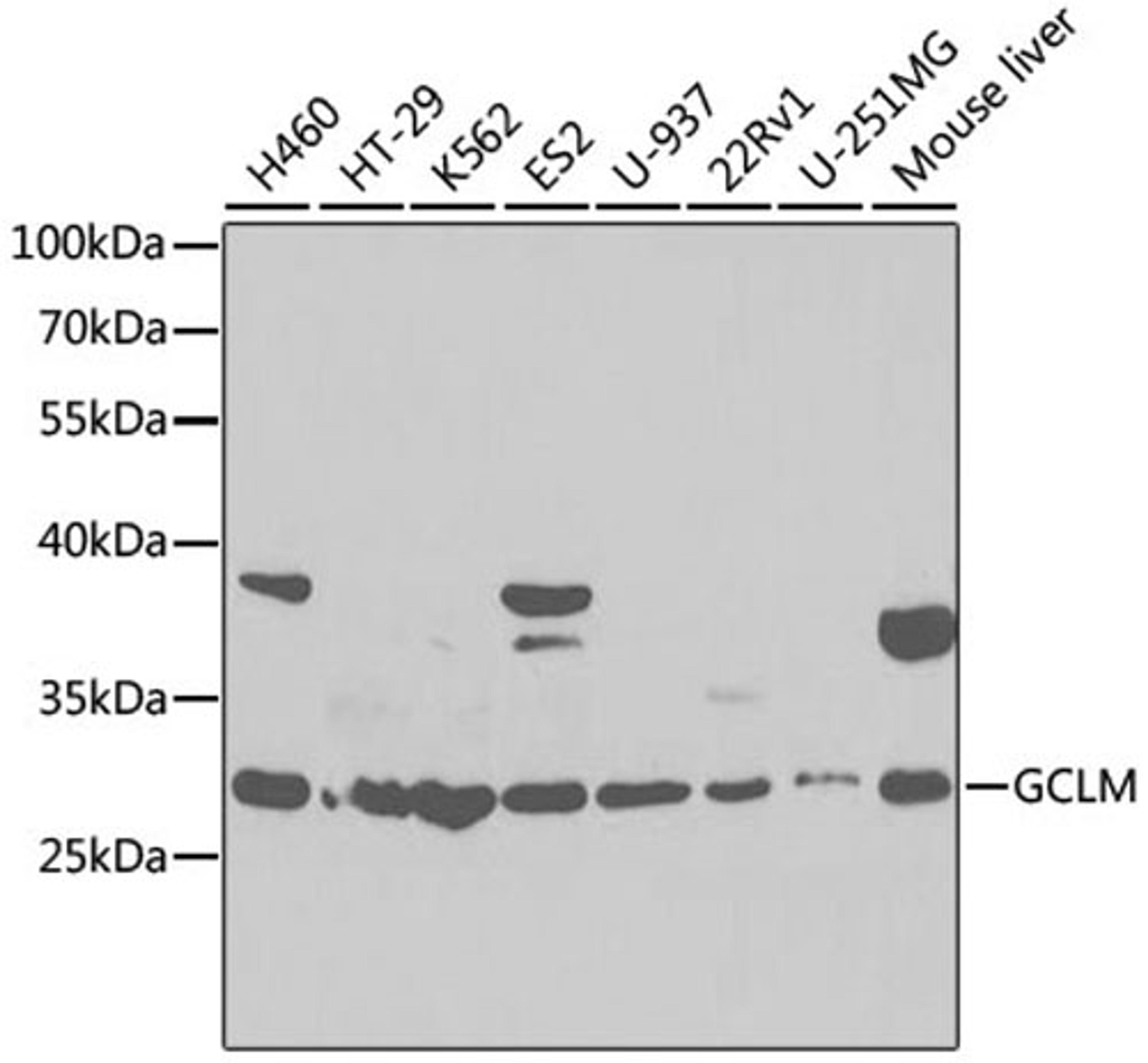 Western blot - GCLM antibody (A13989)