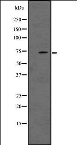 Western blot analysis of A431 whole cell lysate using LRRN1 antibody