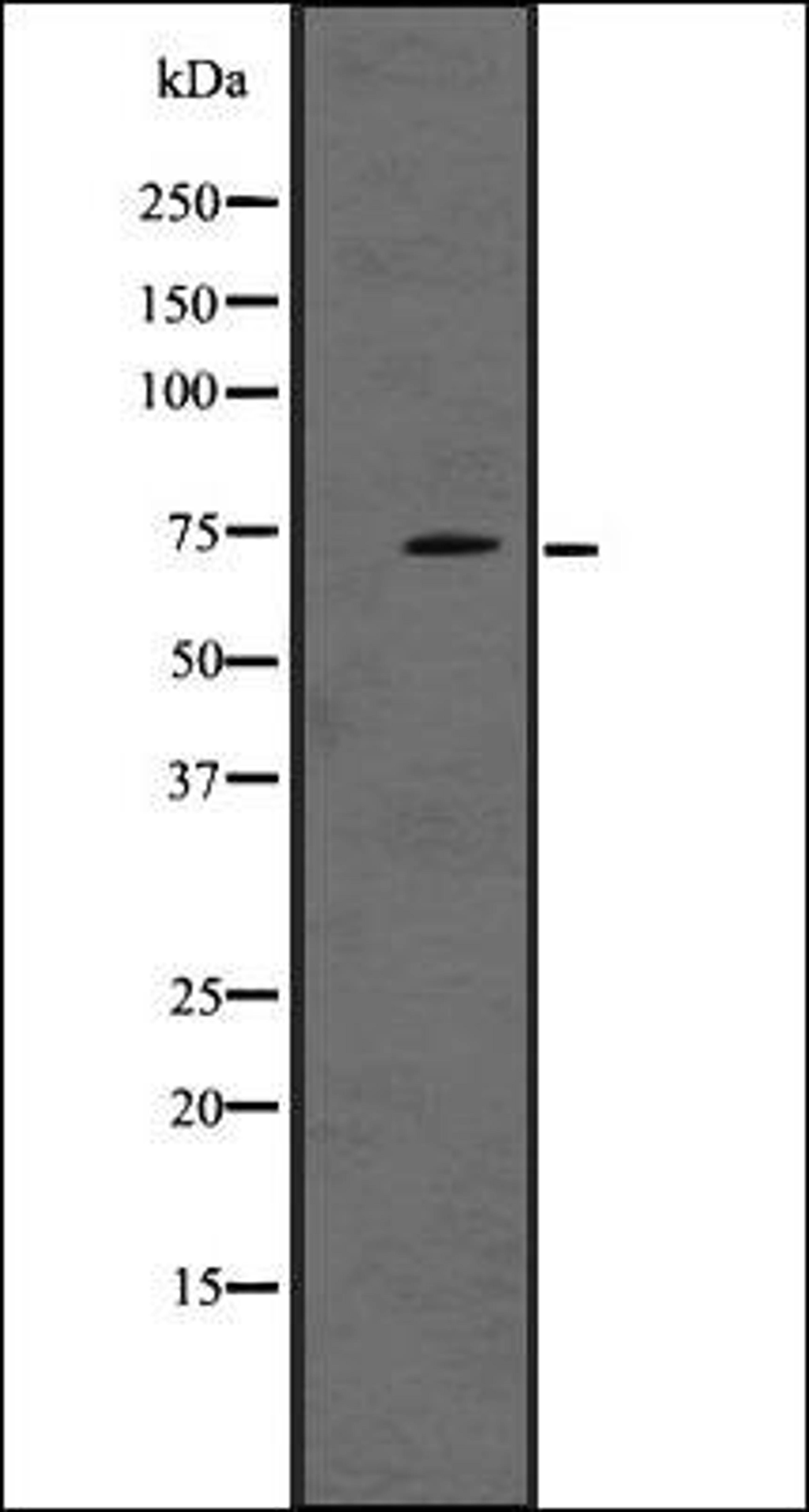 Western blot analysis of A431 whole cell lysate using LRRN1 antibody