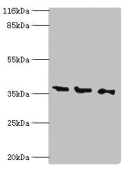Western blot. All lanes: N-acetyl-D-glucosamine kinase antibody at 2ug/ml. Lane 1: HepG2 whole cell lysate. Lane 2: 293T whole cell lysate. Lane 3: Hela whole cell lysate. Secondary. Goat polyclonal to rabbit IgG at 1/10000 dilution. Predicted band size: 38, 43 kDa. Observed band size: 38 kDa.