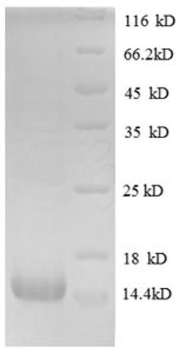 (Tris-Glycine gel) Discontinuous SDS-PAGE (reduced) with 5% enrichment gel and 15% separation gel.
