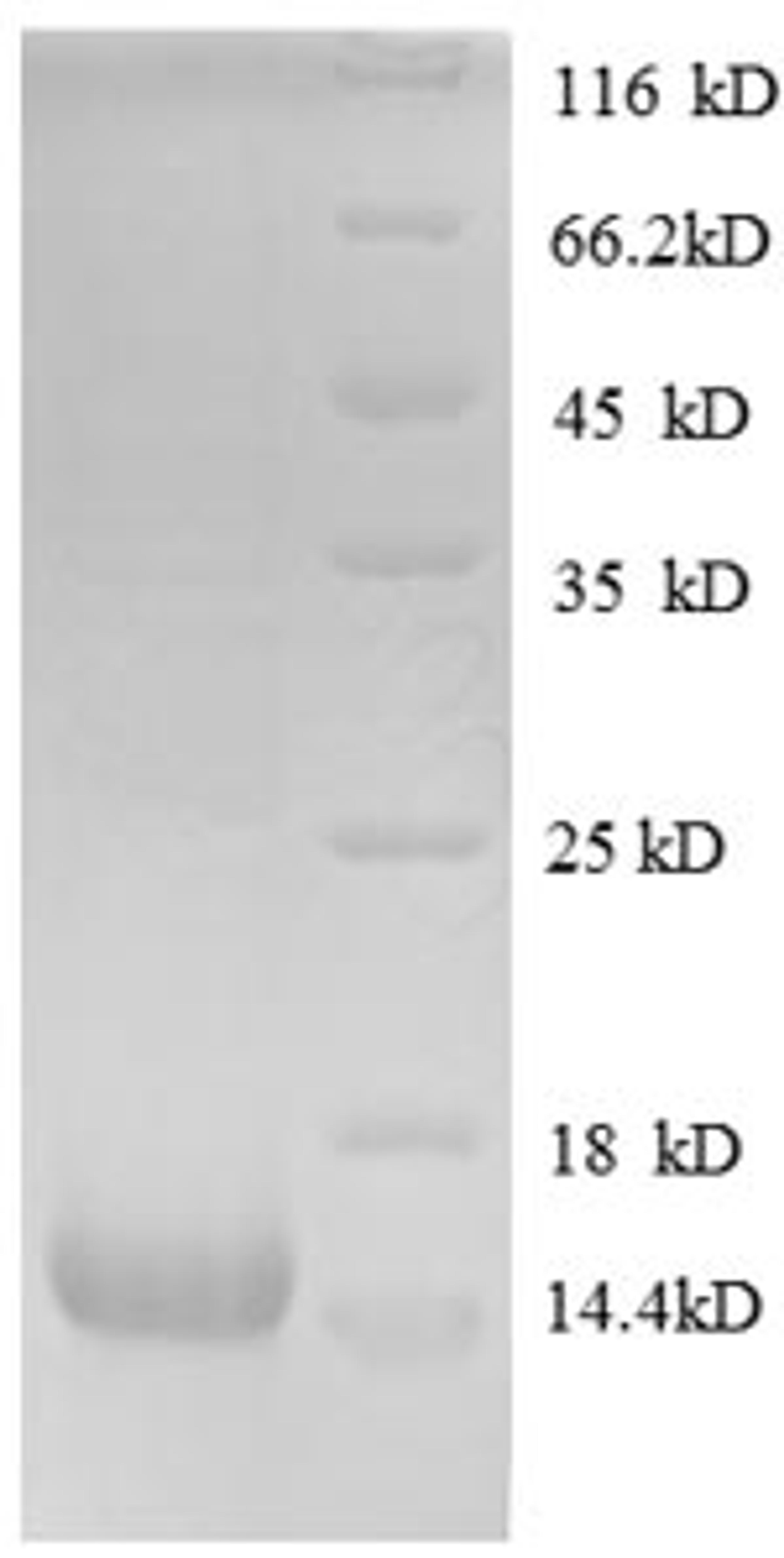 (Tris-Glycine gel) Discontinuous SDS-PAGE (reduced) with 5% enrichment gel and 15% separation gel.