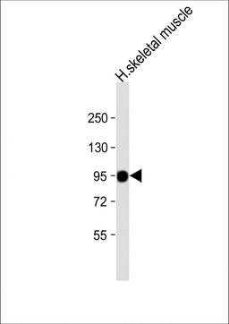 Western Blot at 1:8000 dilution + human skeletal muscle lysate Lysates/proteins at 20 ug per lane.