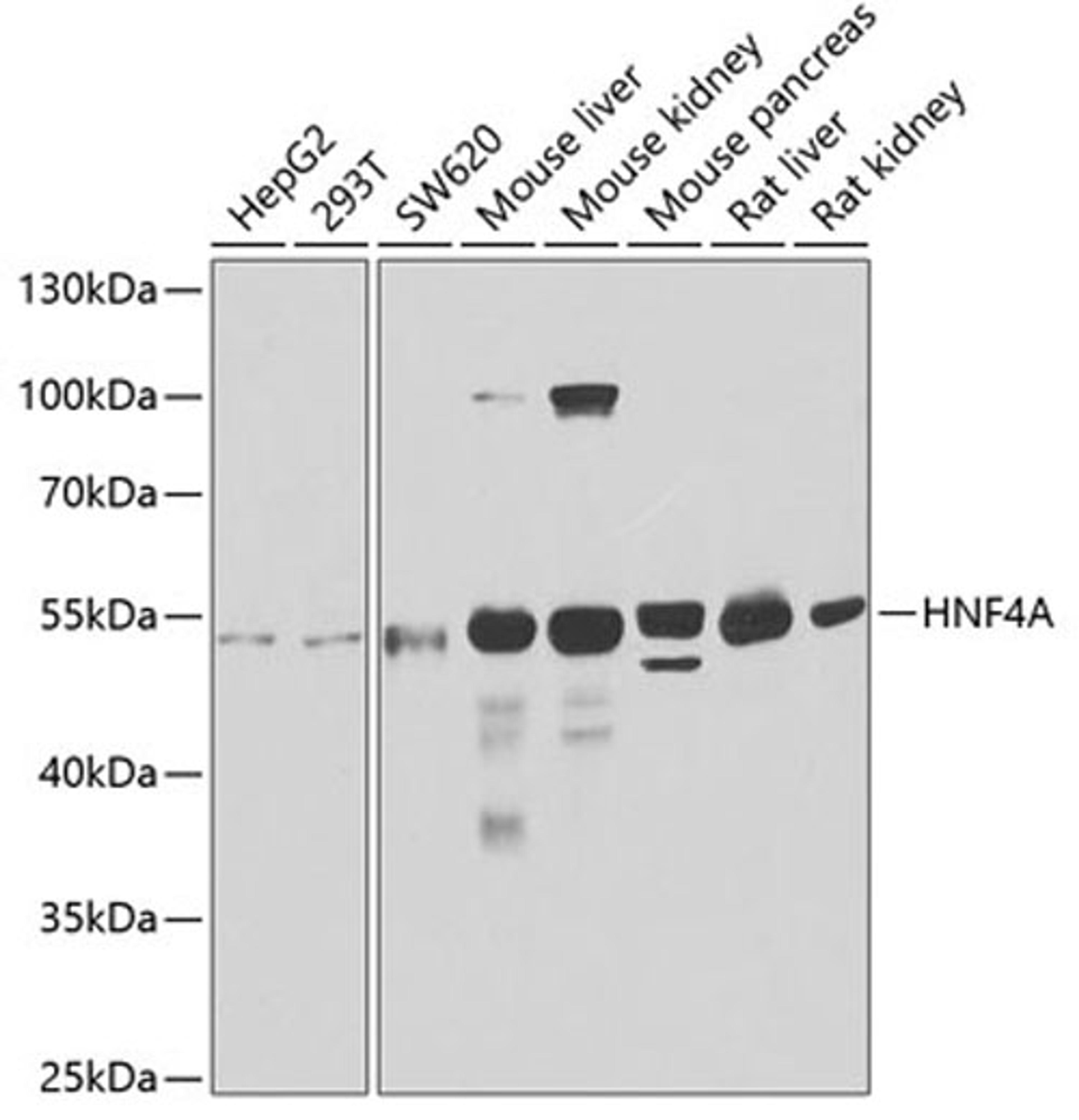 Western blot - HNF4A antibody (A2085)