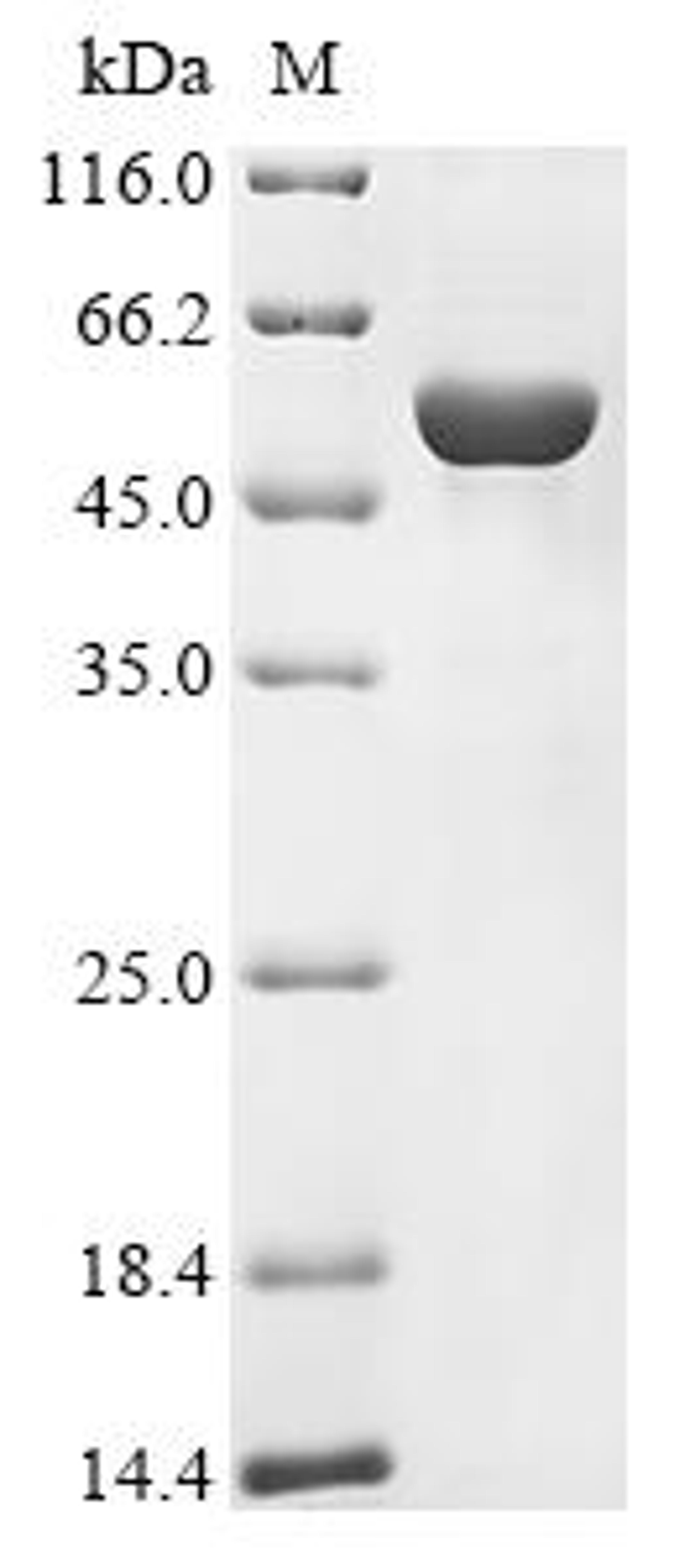 (Tris-Glycine gel) Discontinuous SDS-PAGE (reduced) with 5% enrichment gel and 15% separation gel.