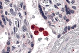 Immunohistochemistry of TLR4 in human placenta tissue with TLR4 antibody at 5 μg/mL.