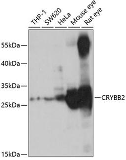 Western blot - CRYBB2 antibody (A5573)