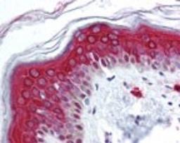 Immunohistochemistry-Paraffin: FOXO3A Antibody [NBP2-24579] - IHC analysis of human skin using NBP2-24579 at 10 ug/ml.