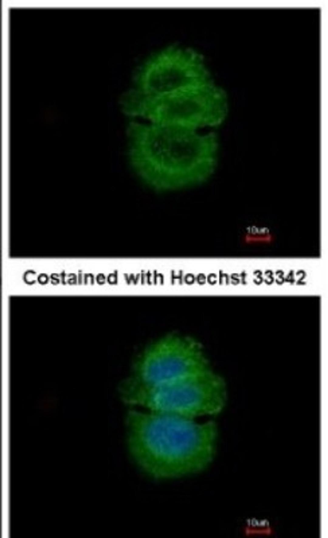 Immunocytochemistry/Immunofluorescence: Alpha-TTP Antibody [NBP2-14870] - Analysis of methanol-fixed MCF-7, using antibody at 1:500 dilution.