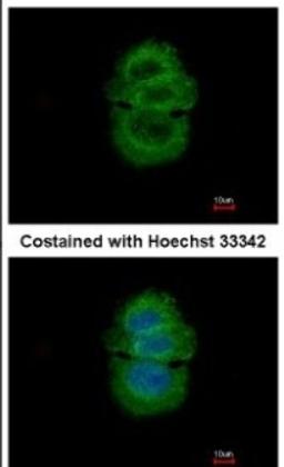 Immunocytochemistry/Immunofluorescence: Alpha-TTP Antibody [NBP2-14870] - Analysis of methanol-fixed MCF-7, using antibody at 1:500 dilution.