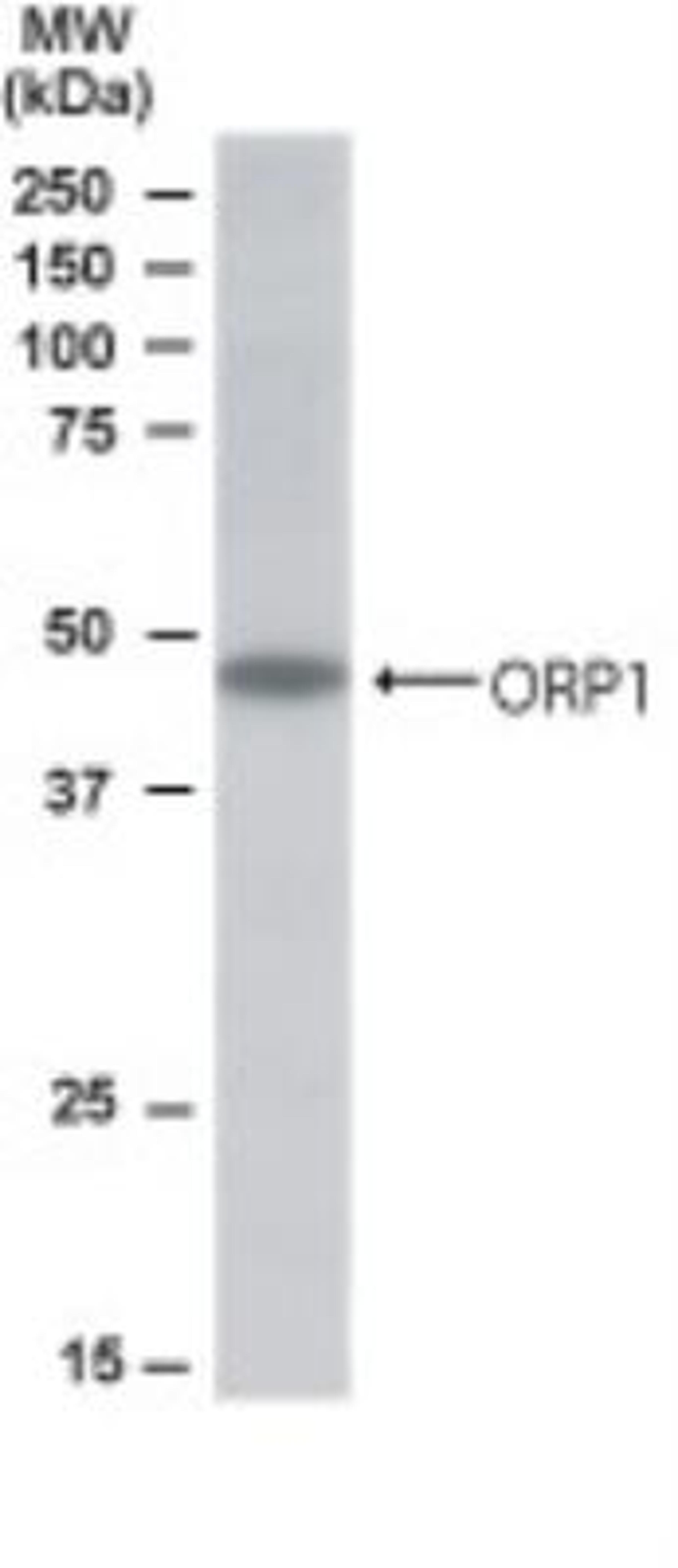 Western Blot: ORP1 Antibody [NB100-1331] - Analysis of ORP1 in Human Muscle lysate using NB100-1331 at 0.5 ug/ ml. Primary incubated for 1 hour. Detected by western blot using chemiluminescence.