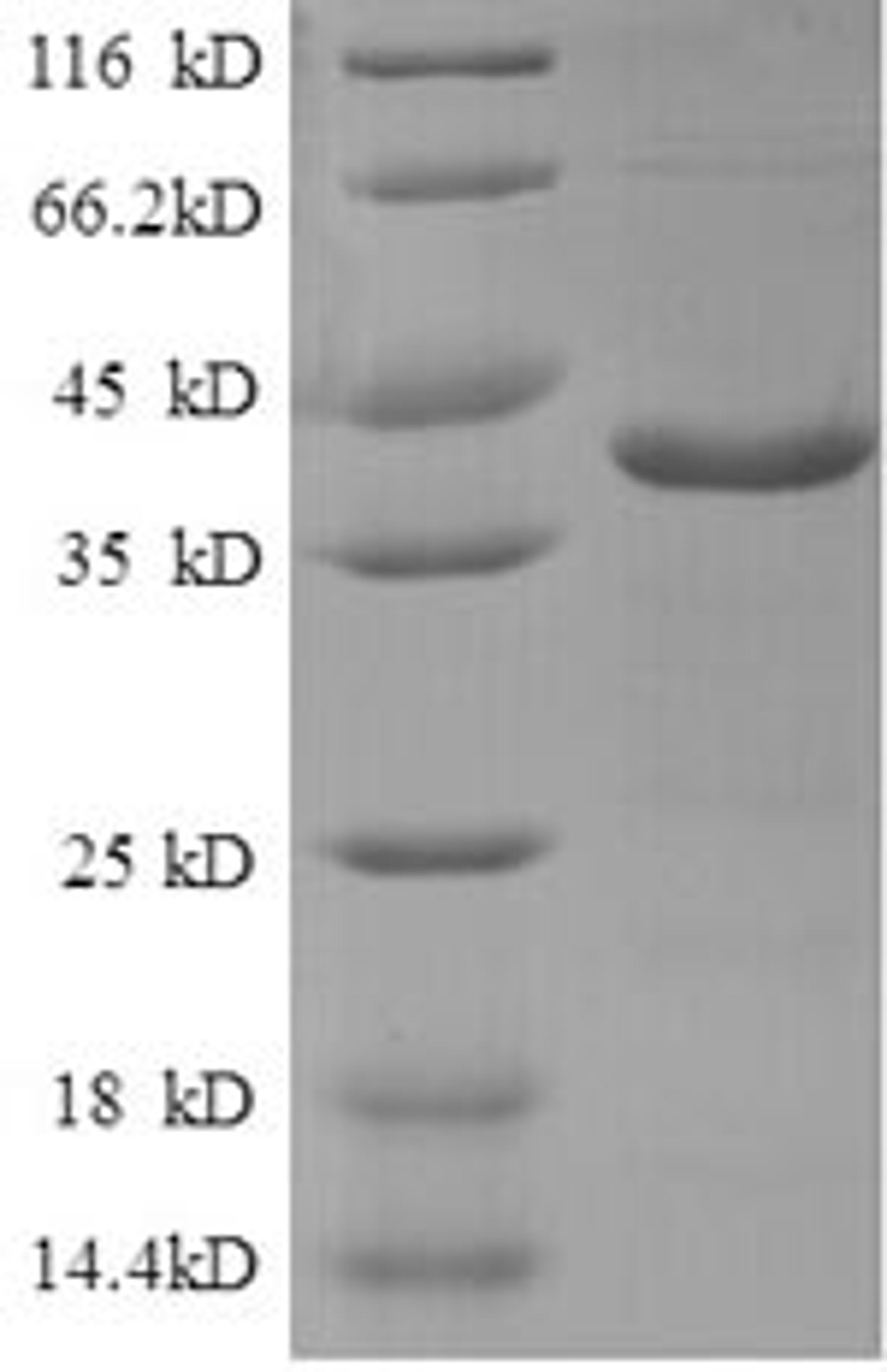 (Tris-Glycine gel) Discontinuous SDS-PAGE (reduced) with 5% enrichment gel and 15% separation gel.