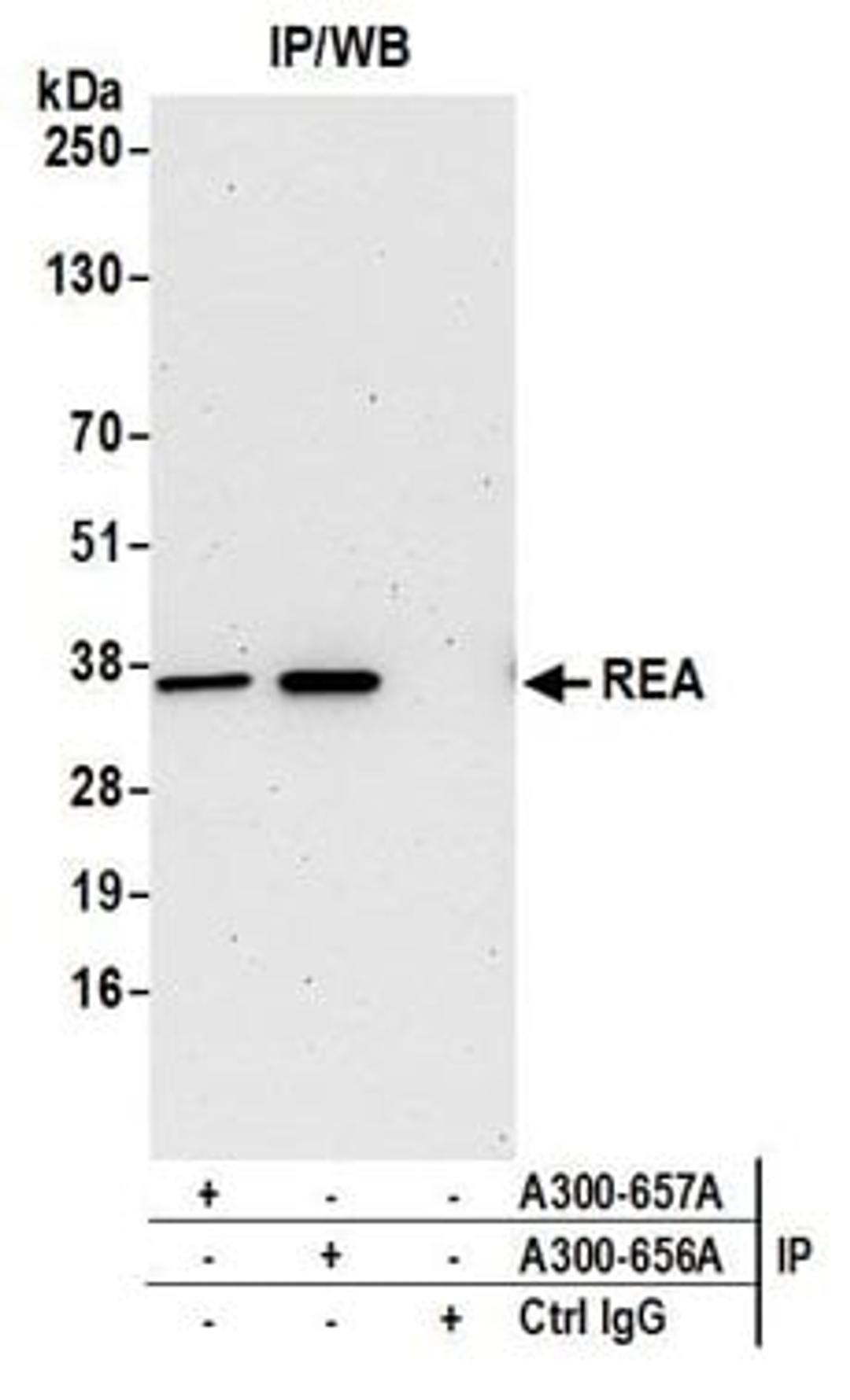 Detection of human REA by western blot of immunoprecipitates.