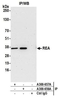 Detection of human REA by western blot of immunoprecipitates.