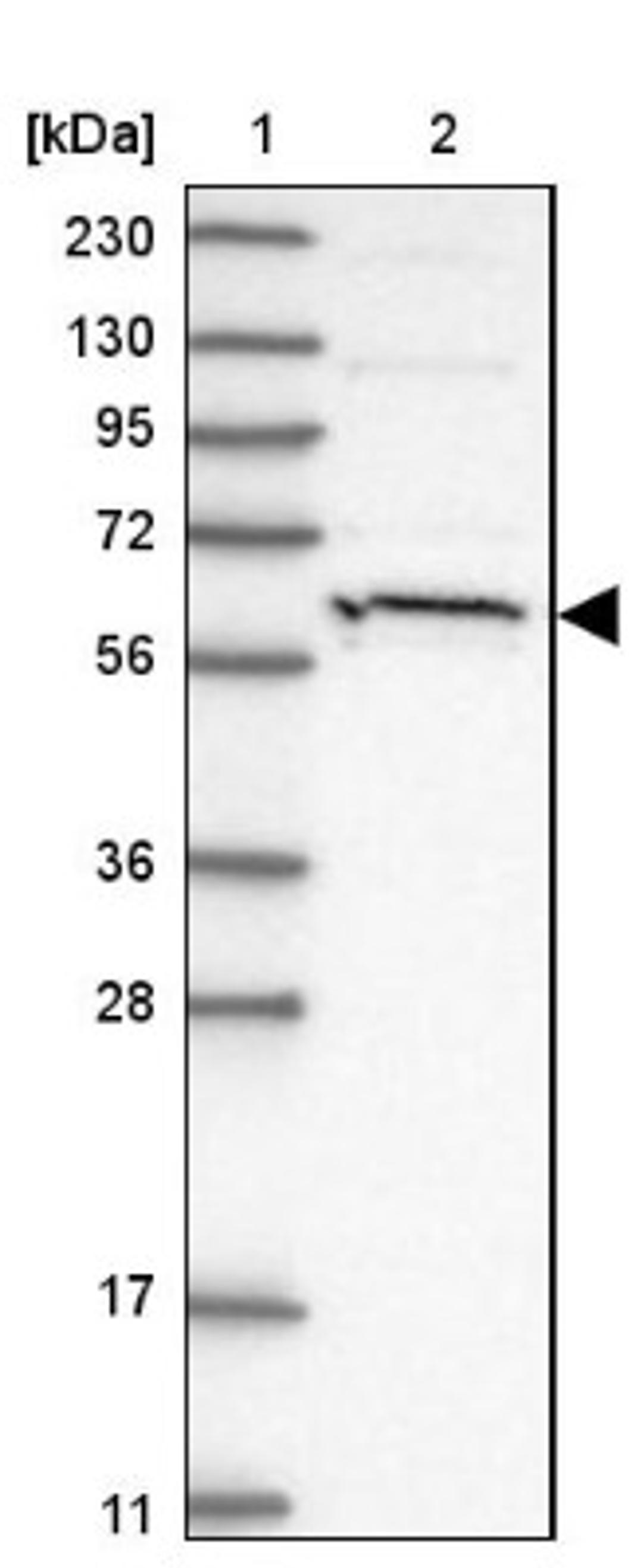 Western Blot: HIC2 Antibody [NBP1-81710] - Lane 1: Marker [kDa] 230, 130, 95, 72, 56, 36, 28, 17, 11<br/>Lane 2: Human cell line RT-4