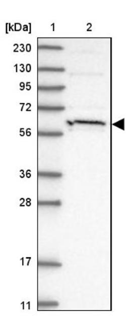 Western Blot: HIC2 Antibody [NBP1-81710] - Lane 1: Marker [kDa] 230, 130, 95, 72, 56, 36, 28, 17, 11<br/>Lane 2: Human cell line RT-4