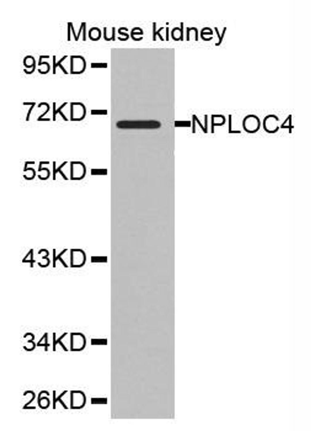 Western blot analysis of extracts of mouse kidney cell line using NPLOC4 antibody