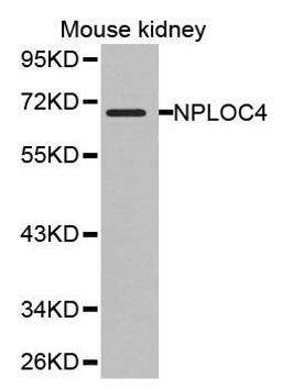 Western blot analysis of extracts of mouse kidney cell line using NPLOC4 antibody