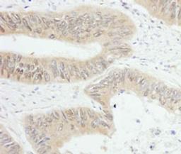 Detection of human PTPN12 by immunohistochemistry.