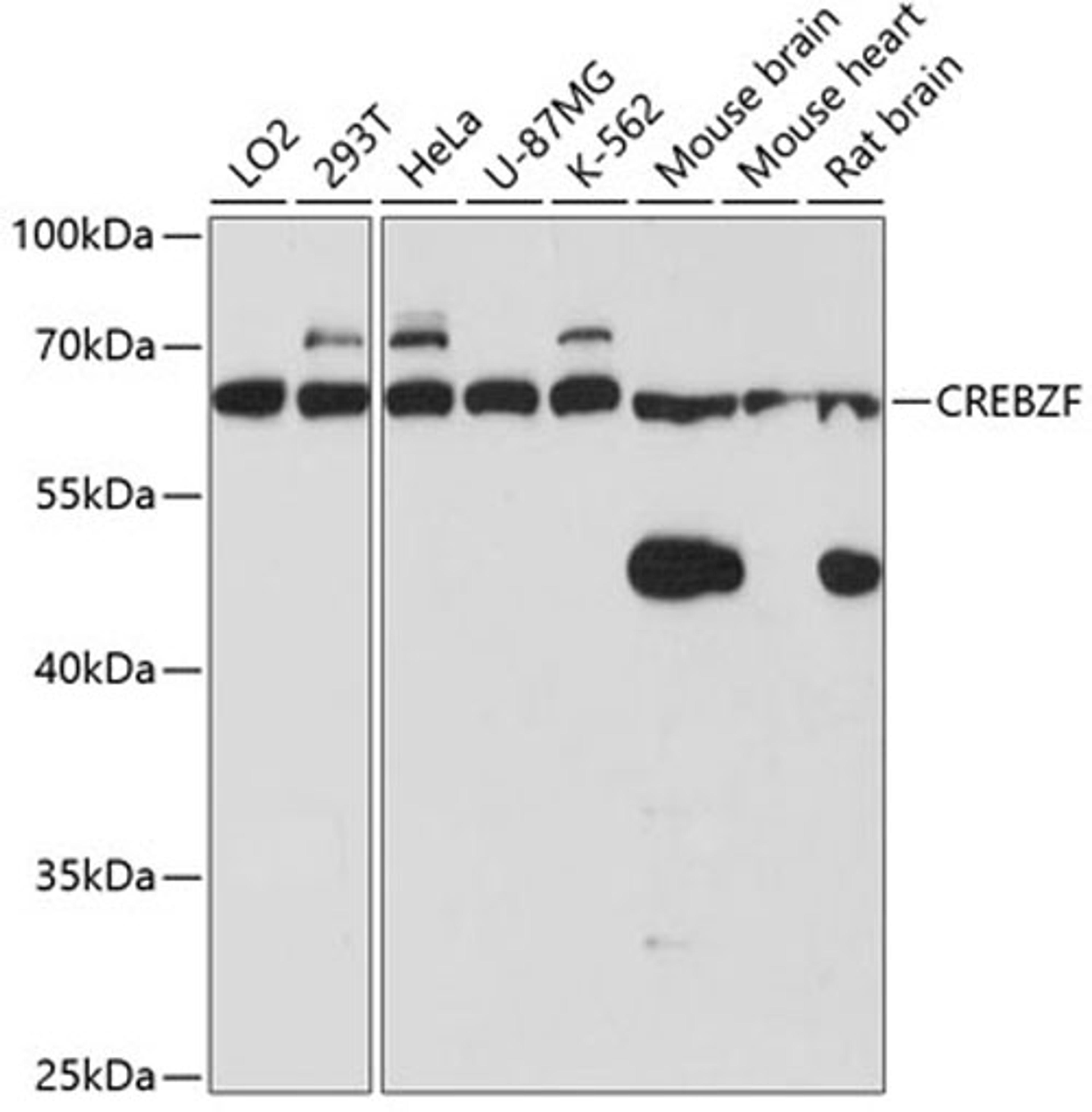 Western blot - CREBZF antibody (A3477)