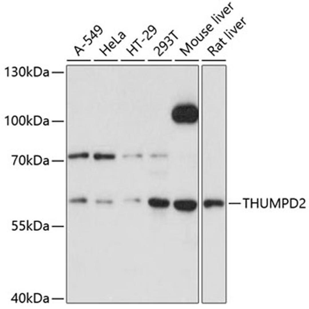 Western blot - THUMPD2 Antibody (A11717)