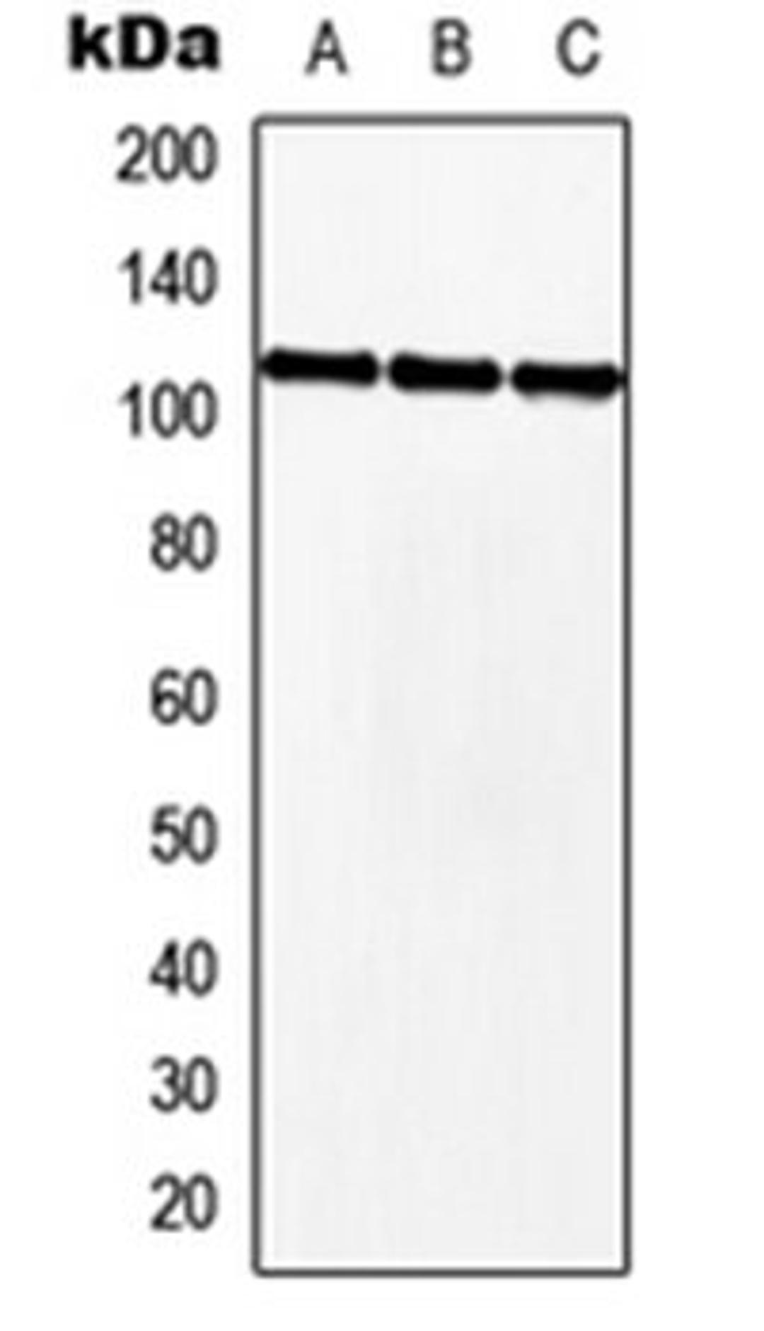 Western blot analysis of HEK293T (Lane 1), NIH3T3 (Lane 2), H9C2 (Lane 3) whole cell lysates using MKL2 antibody