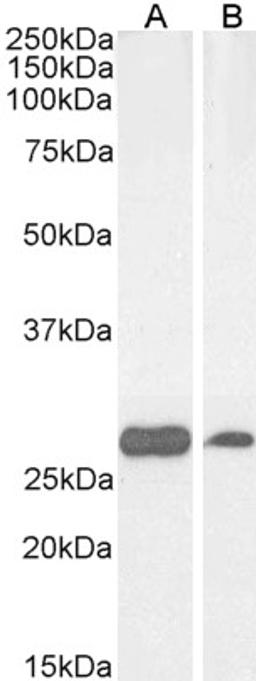 46-171 (0.03ug/ml) staining of Human Cerebellum (A) and Liver (B) lysate (35ug protein in RIPA buffer). Primary incubation was 1 hour. Detected by chemiluminescence.