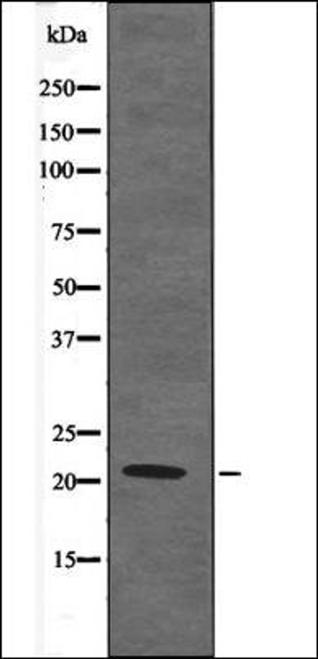 Western blot analysis of K562 whole cell lysates using Claudin 4 -Phospho-Tyr208- antibody