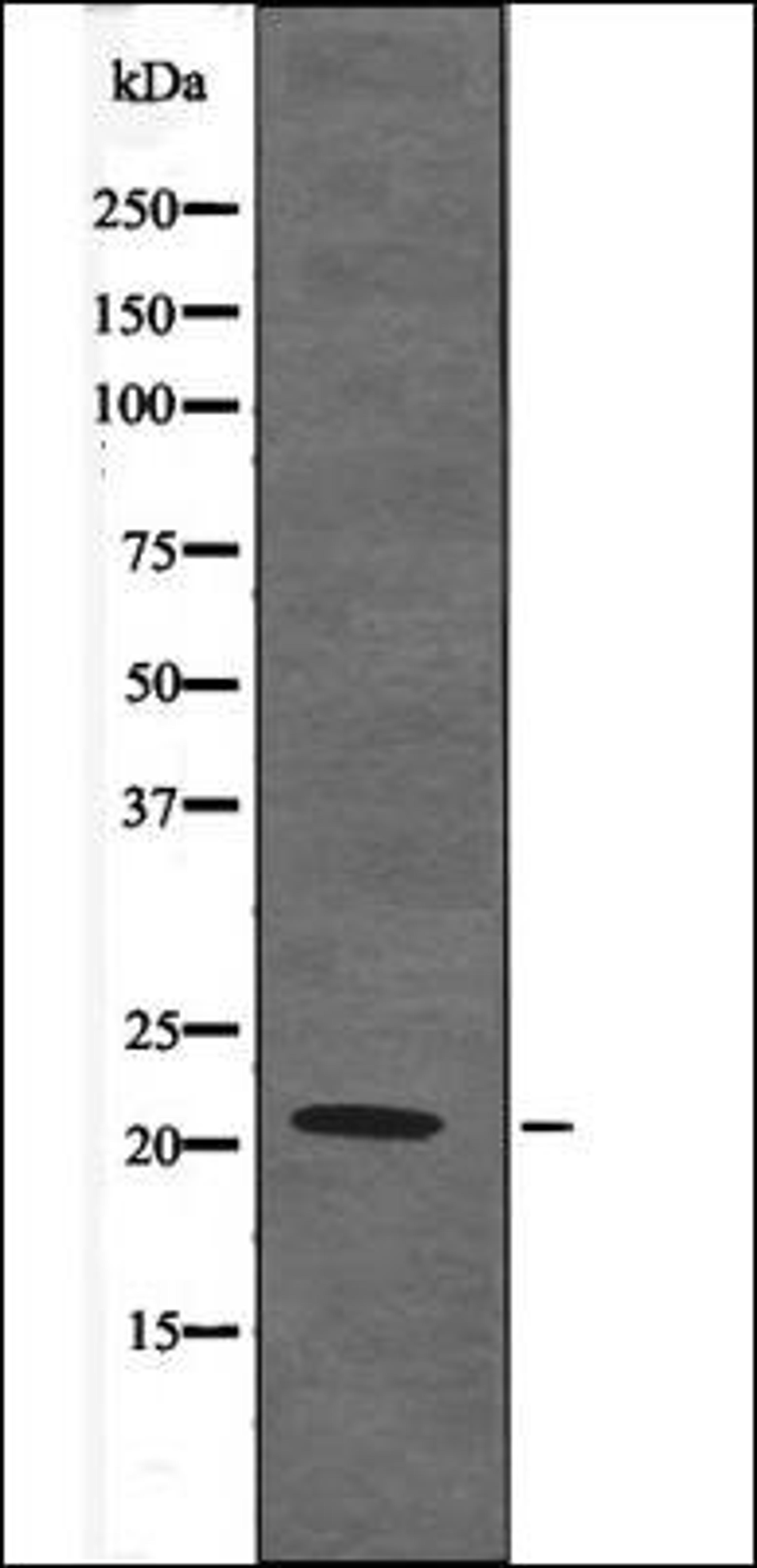 Western blot analysis of K562 whole cell lysates using Claudin 4 -Phospho-Tyr208- antibody