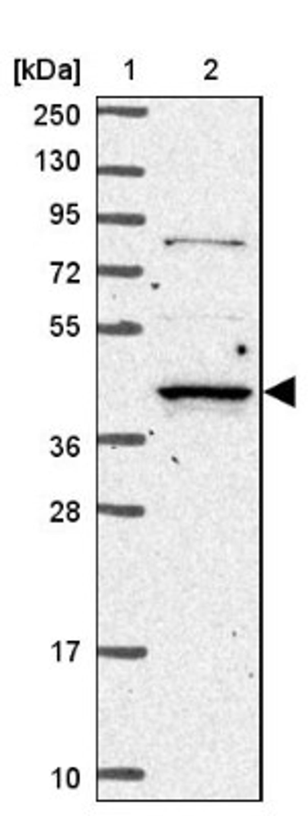 Western Blot: RASSF2 Antibody [NBP2-13206] - Lane 1: Marker [kDa] 250, 130, 95, 72, 55, 36, 28, 17, 10<br/>Lane 2: Human cell line RT-4