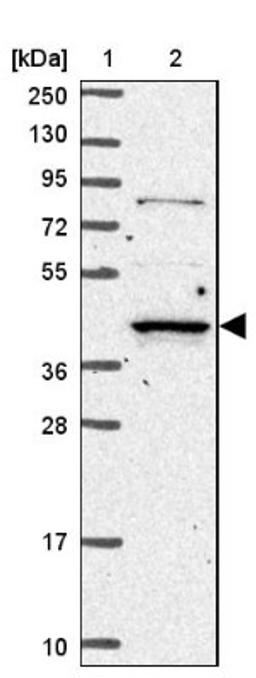 Western Blot: RASSF2 Antibody [NBP2-13206] - Lane 1: Marker [kDa] 250, 130, 95, 72, 55, 36, 28, 17, 10<br/>Lane 2: Human cell line RT-4