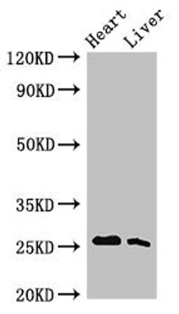 Western Blot. Positive WB detected in: Rat heart tissue, Rat liver tissue. All lanes: Tnni3 antibody at 2.5ug/ml. Secondary. Goat polyclonal to rabbit IgG at 1/50000 dilution. Predicted band size: 25 kDa. Observed band size: 25 kDa. 