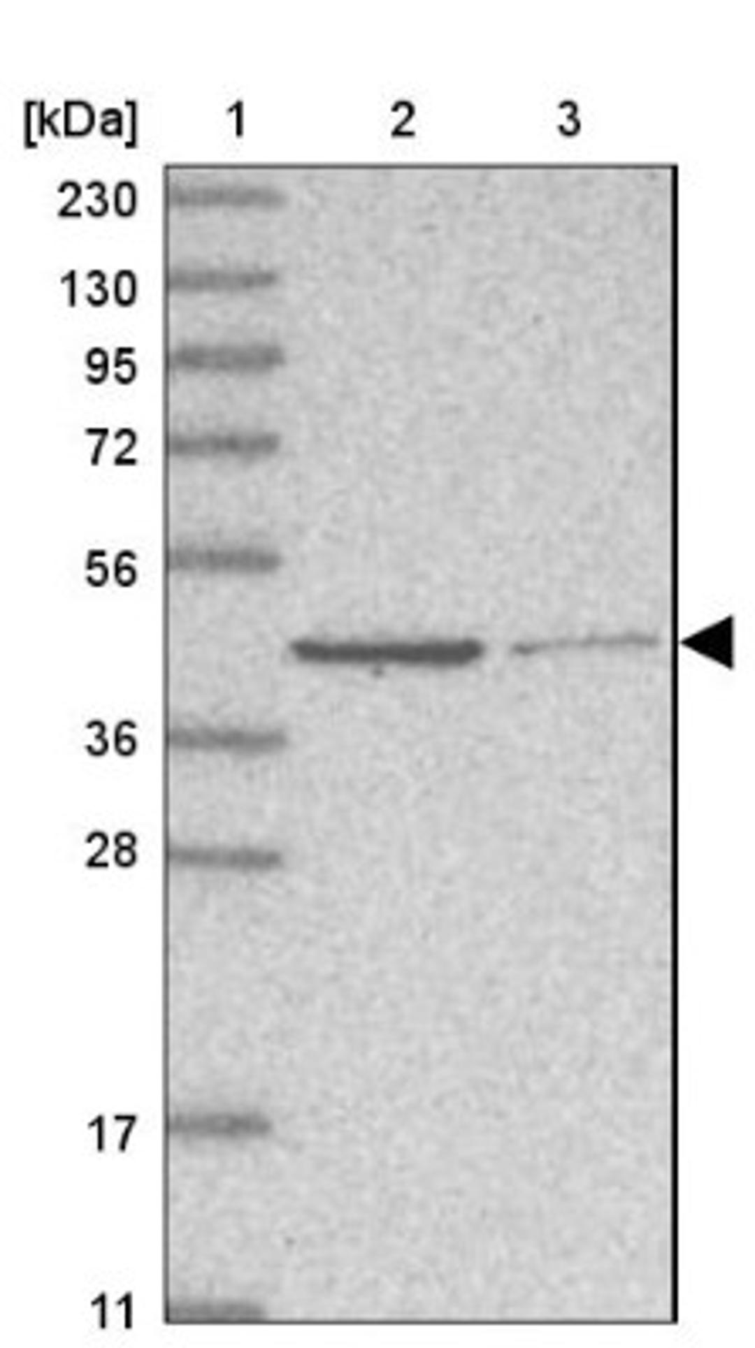 Western Blot: GMPPA Antibody [NBP1-85904] - Lane 1: Marker [kDa] 230, 130, 95, 72, 56, 36, 28, 17, 11<br/>Lane 2: Human cell line RT-4<br/>Lane 3: Human cell line U-251MG sp