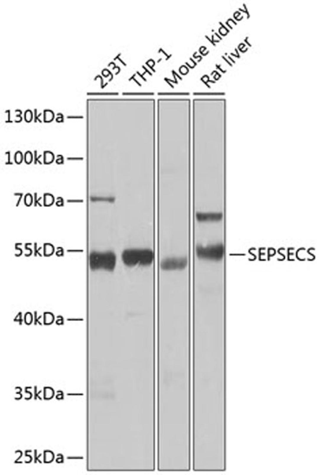 Western blot - SEPSECS Antibody (A7103)