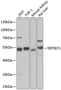 Western blot - SEPSECS Antibody (A7103)