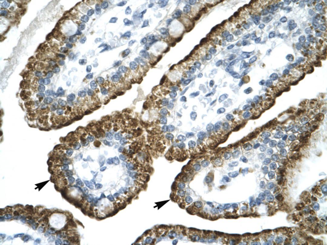 Antibody used in IHC on Human Intestine.