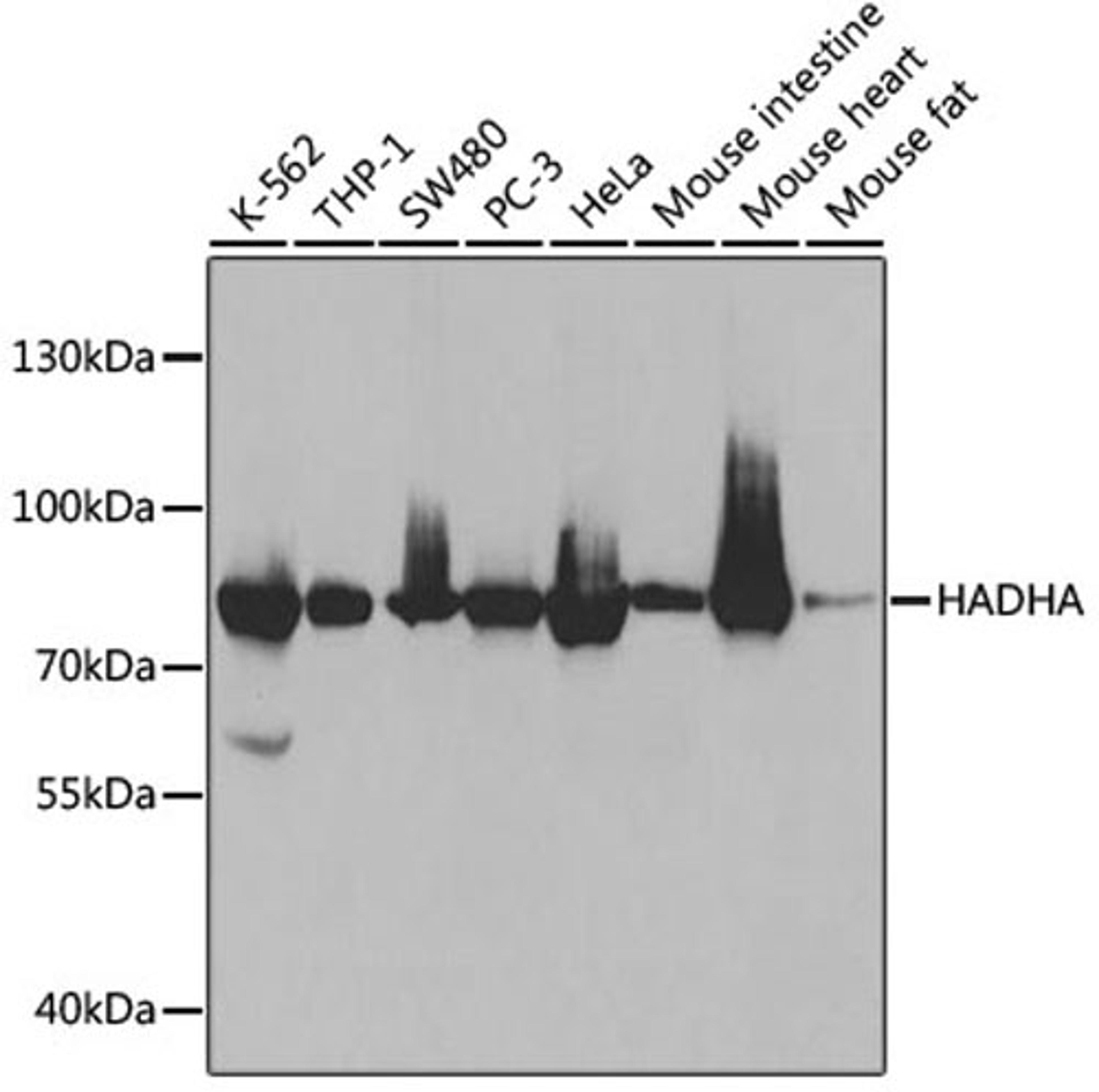 Western blot - HADHA antibody (A5346)