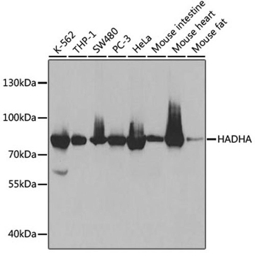 Western blot - HADHA antibody (A5346)