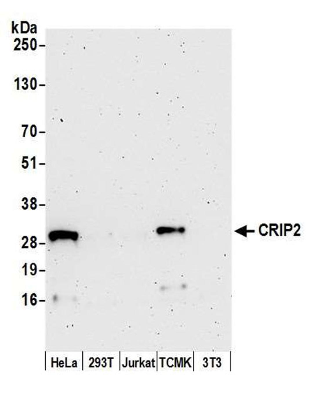 Detection of human and mouse CRIP2 by WB.