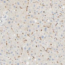 Immunohistochemistry-Paraffin: FCRN/FCGRT Antibody [NBP1-89128] - Staining of human liver shows positivity of a subset of cells in sinusoids.