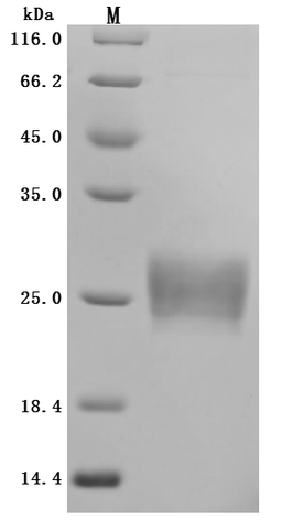 (Tris-Glycine gel) Discontinuous SDS-PAGE (reduced) with 5% enrichment gel and 15% separation gel.