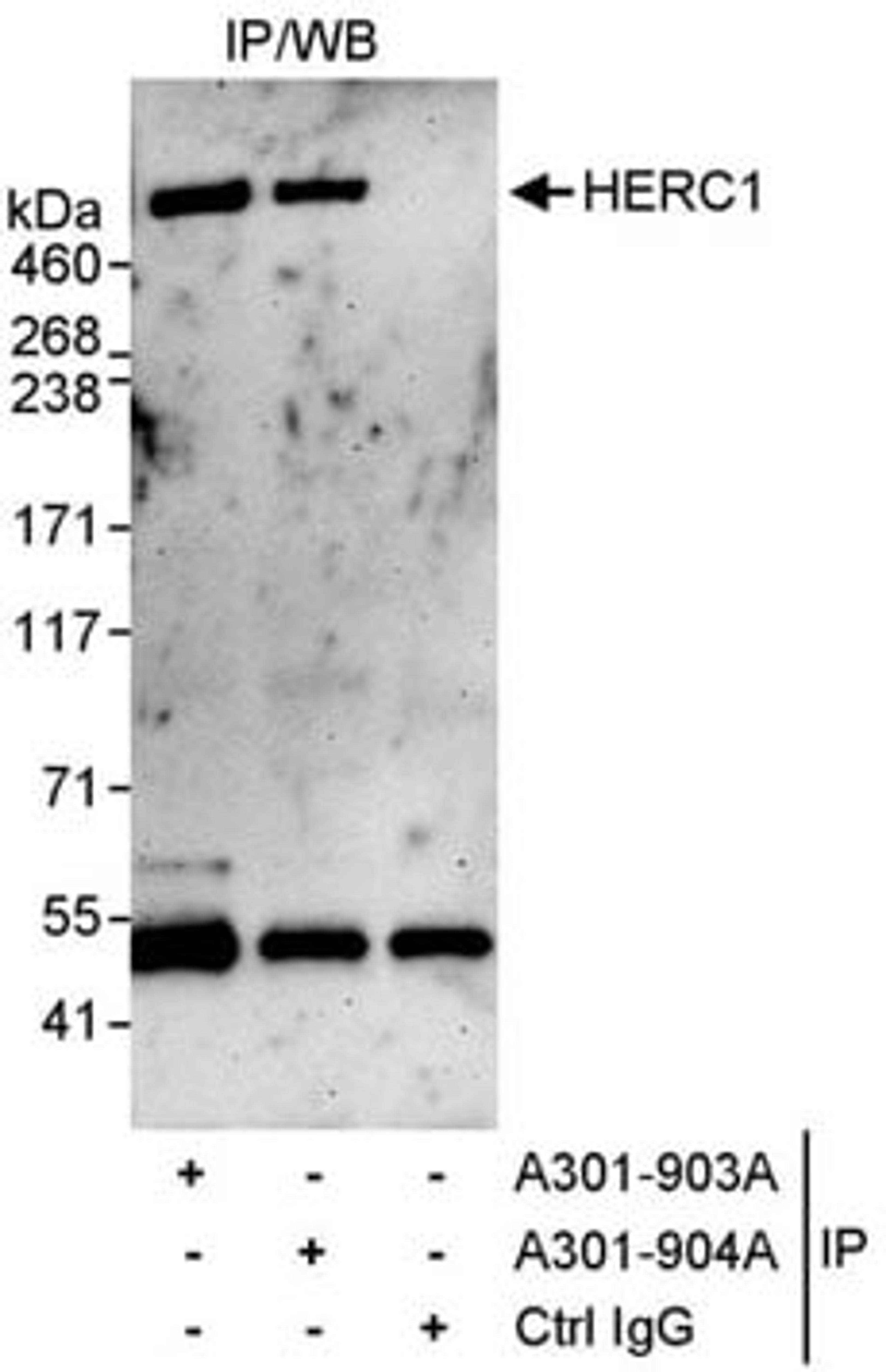 Detection of human HERC1 by western blot of immunoprecipitates.