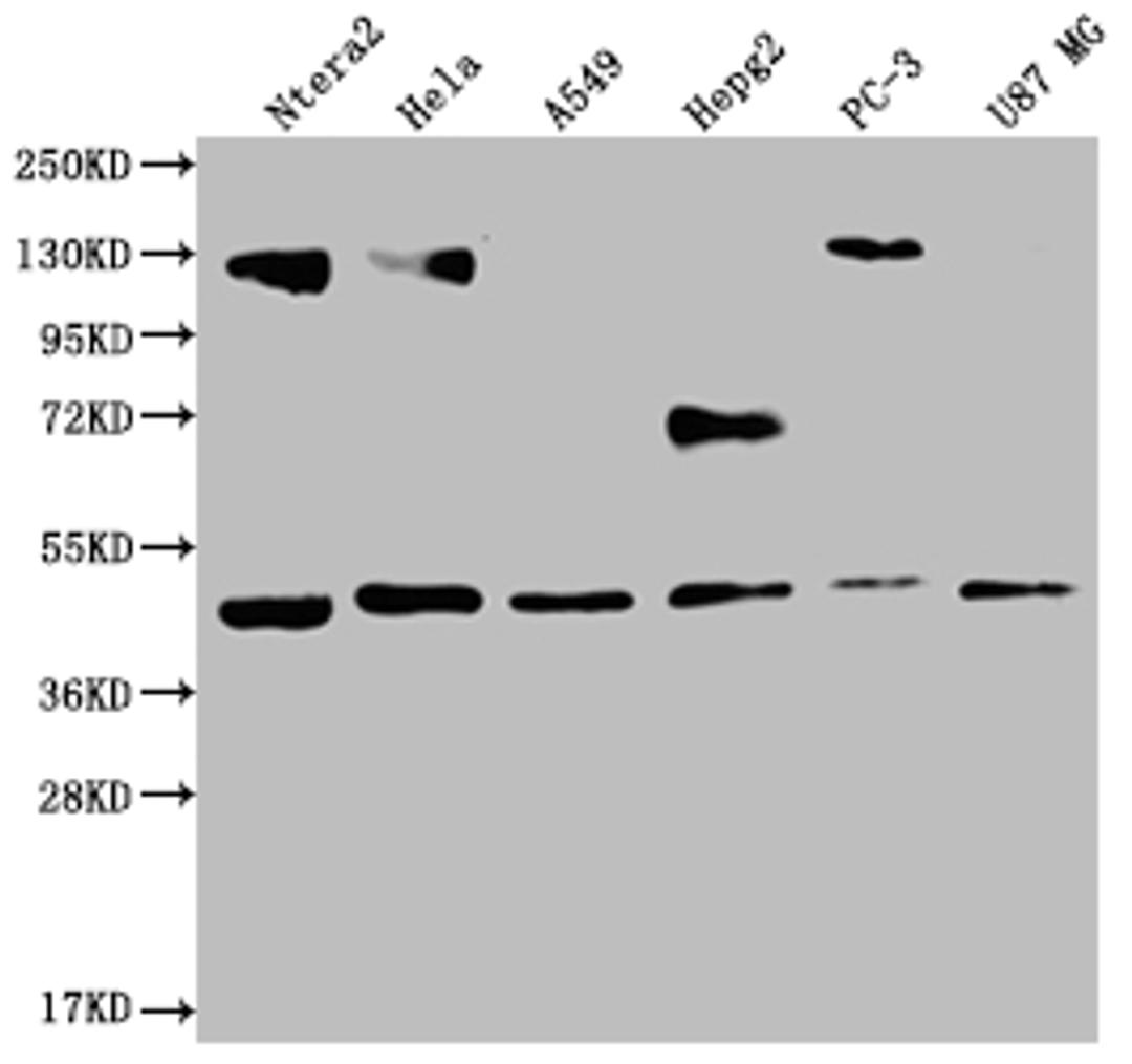 Western Blot. Positive WB detected in: Ntera-2 whole cell lysate, Hela whole cell lysate, A549 whole cell lysate, HepG2 whole cell lysate, PC3 whole cell lysate, U87 whole cell lysate. All lanes: HIF1AN antibody at 1:2000. Secondary. Goat polyclonal to rabbit IgG at 1/50000 dilution. Predicted band size: 41 kDa. Observed band size: 36-53 kDa.